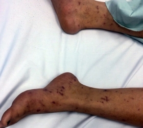 Thiếu nữ 15 tuổi nhập viện khiến hàng chục người phải di chuyển cách ly